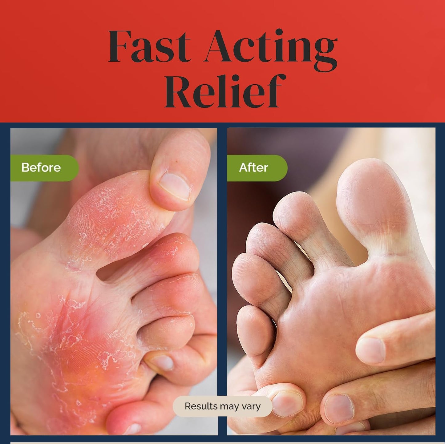 Body Wipes - Curing and Soothing Skin, Alcohol-Free, Non-Toxic, Medicated Wipes Formula for Athlete Feet, Jock Itch, Ringworms. Rinse-Free Gym Wipes for Men and Women - 80 Wipes