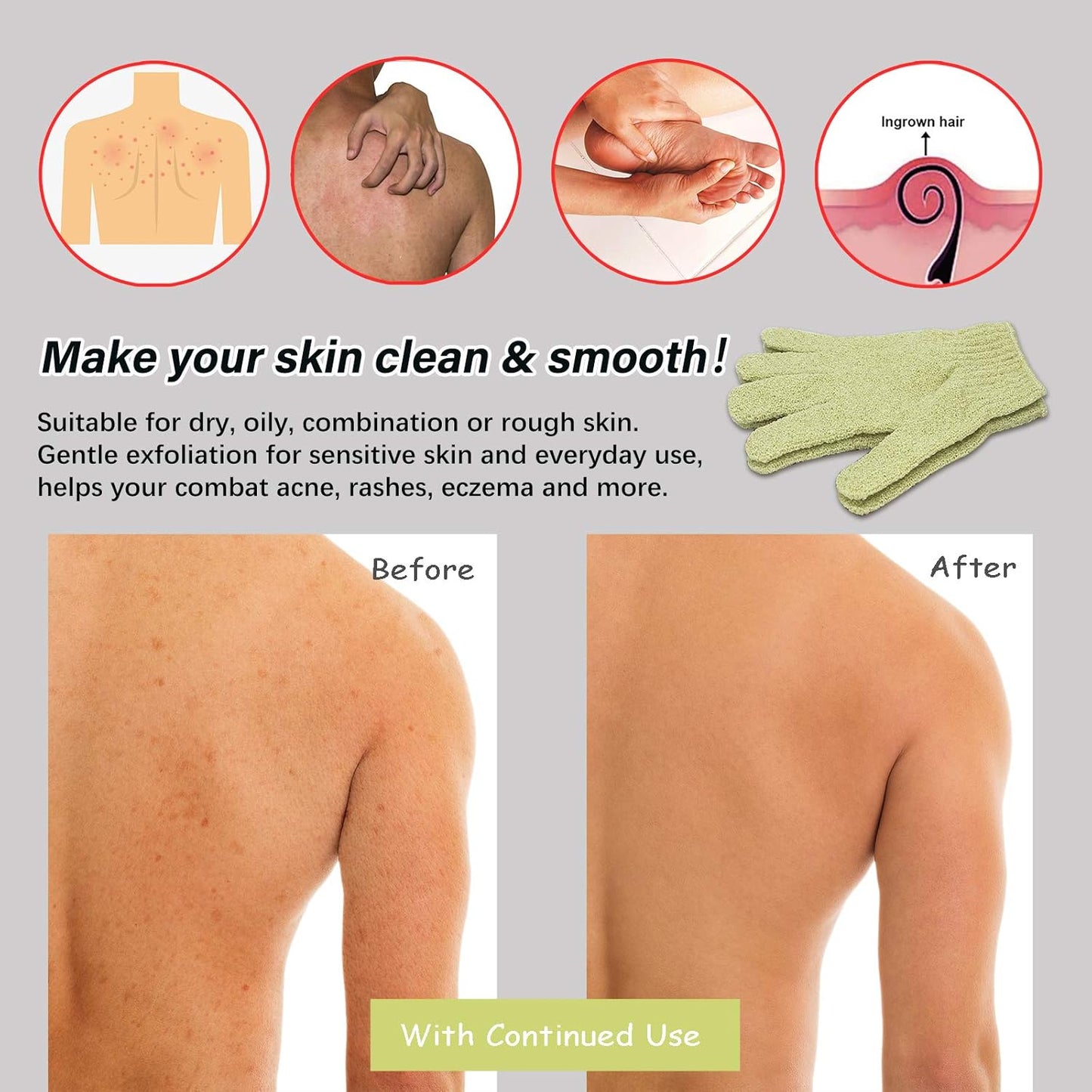 MIG4U Shower Exfoliating Scrub Gloves, Bathing Gloves Body Wash Dead Skin Removal Deep Cleansing Sponge Loofah for Women Men