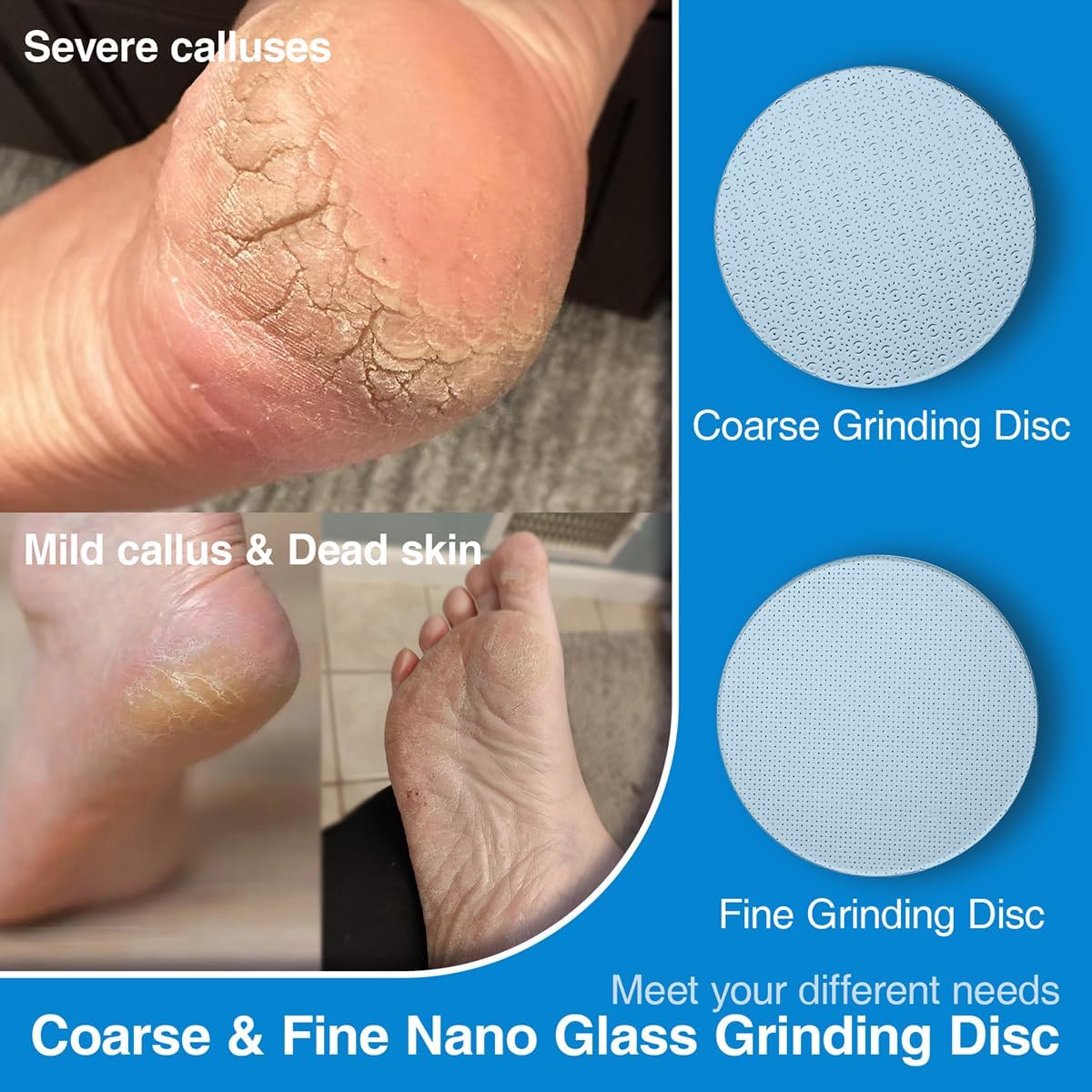 2 Pcs Nano Glass Grinding Replaceable Disc for Dermave Electric Foot Callus Remover with 60 Pieces Replaceable Round Double-Sided Adhesive Pads