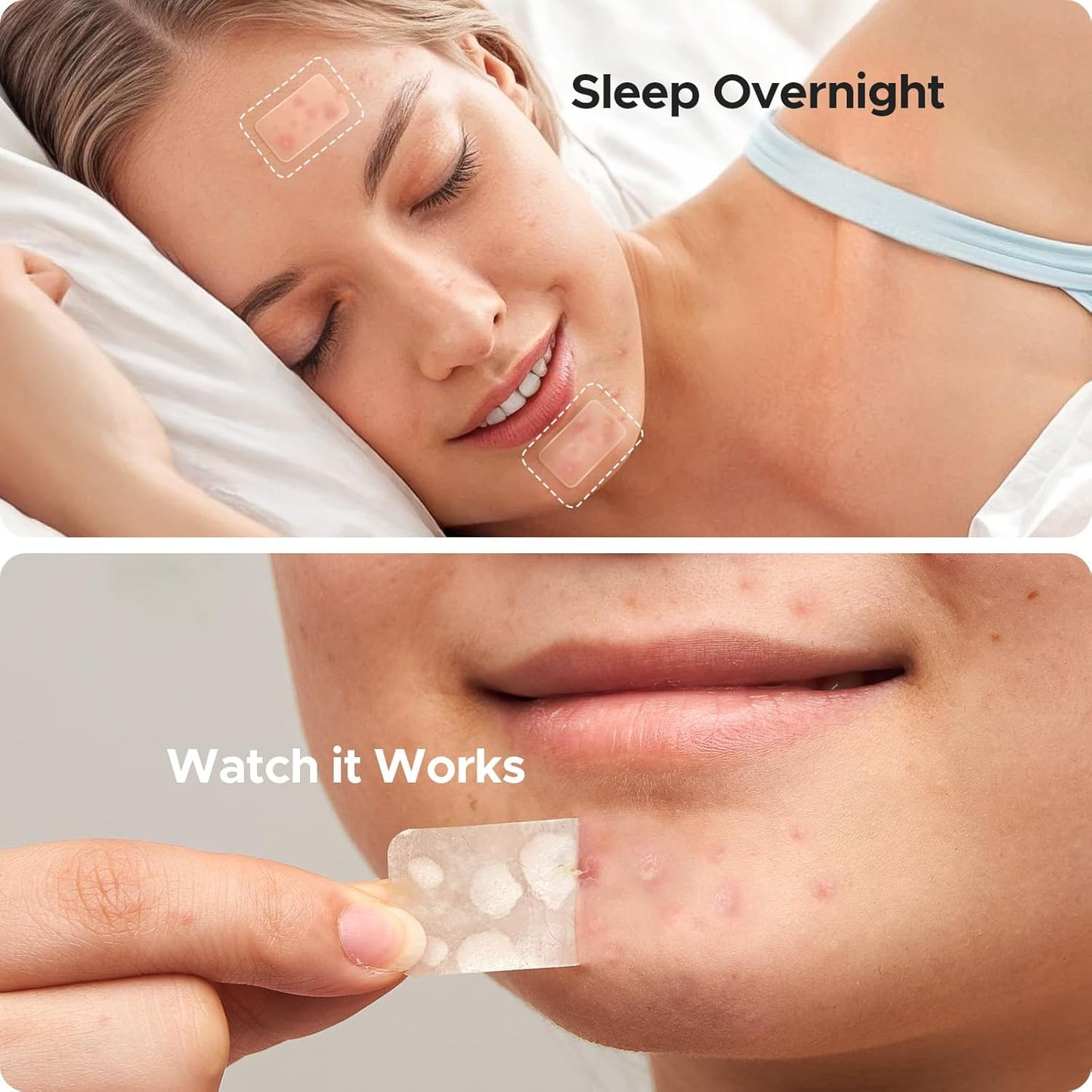 Large Pimple Patches for Face, 7 Sizes Big Acne Patches, XL Hydrocolloid Bandages for Body, Chin, Forehead, Nose, Back Blemish Zit Breakouts, Hydrocolloid Patch (Square, Strip, Dot 306 Count)