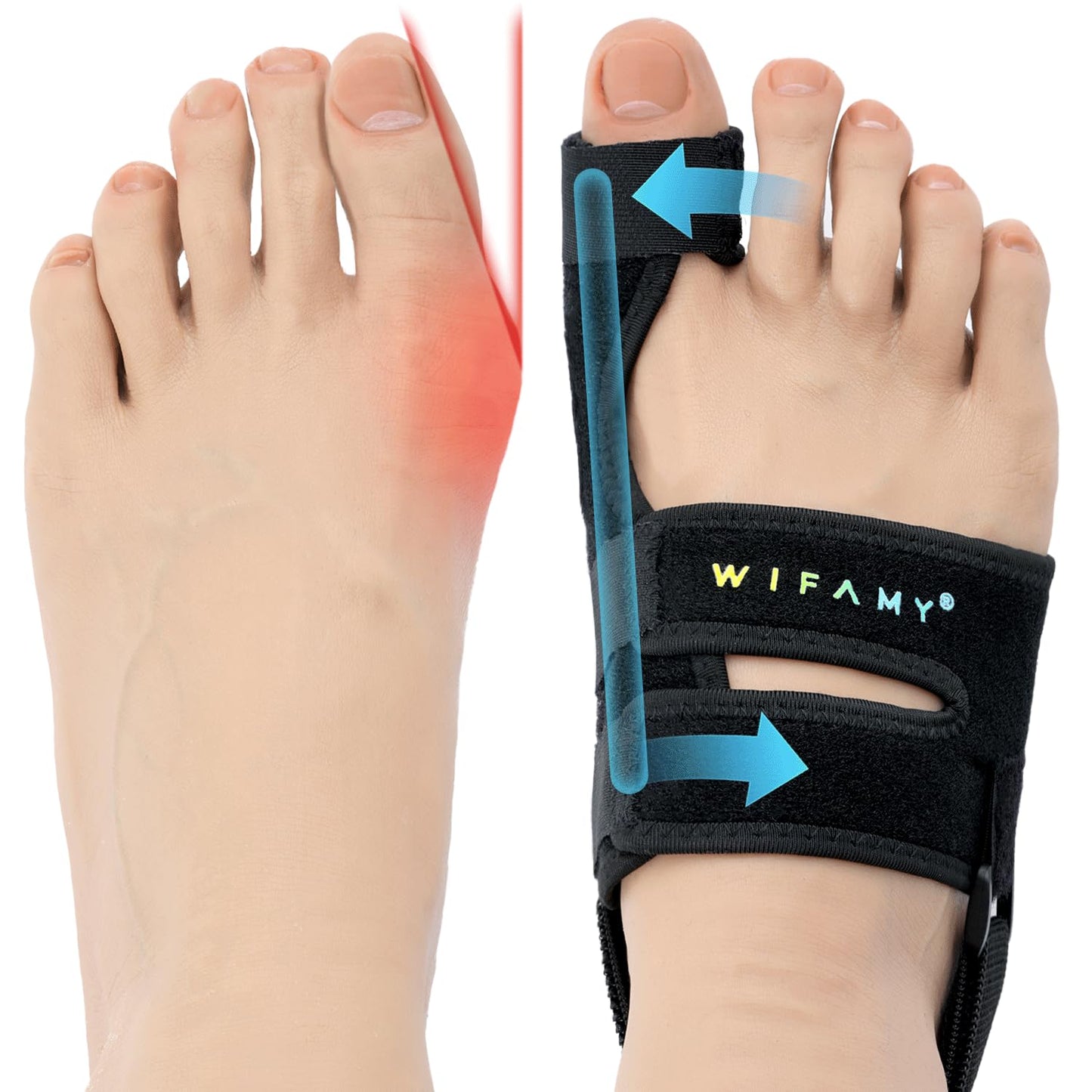 Bunion Corrector For Women Big Toe: Soft Gel Toe Separators For Women - Adjustable Straps & Breathable Design - Day/Night Pain Relief For High Heels & Flats