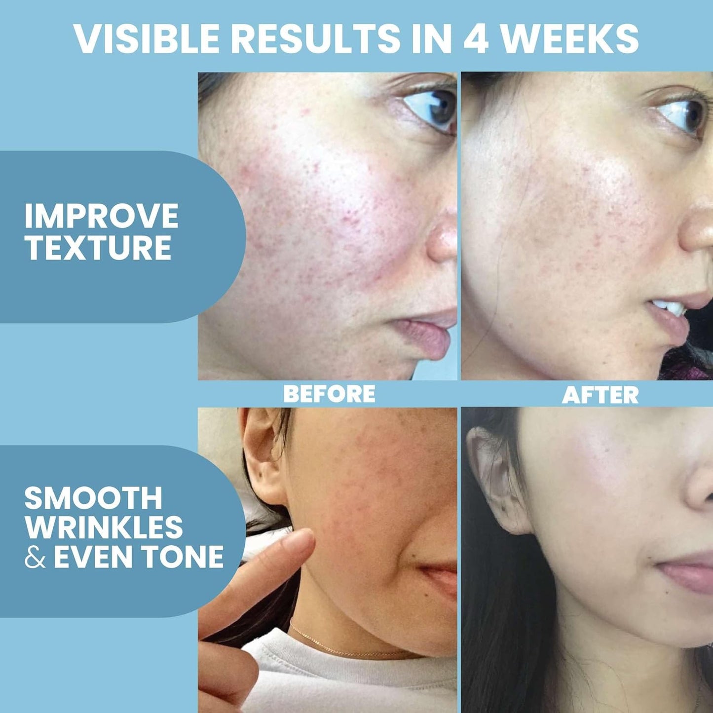 Collagen Peptide Serum for Face – Anti Aging Facial Treatment with Peptides & Hyaluronic Acid – Gentle for Sensitive Skin, Microneedling Pen, Derma Roller, Skin Firming & Hydrating (2 Oz) (2 Pack)