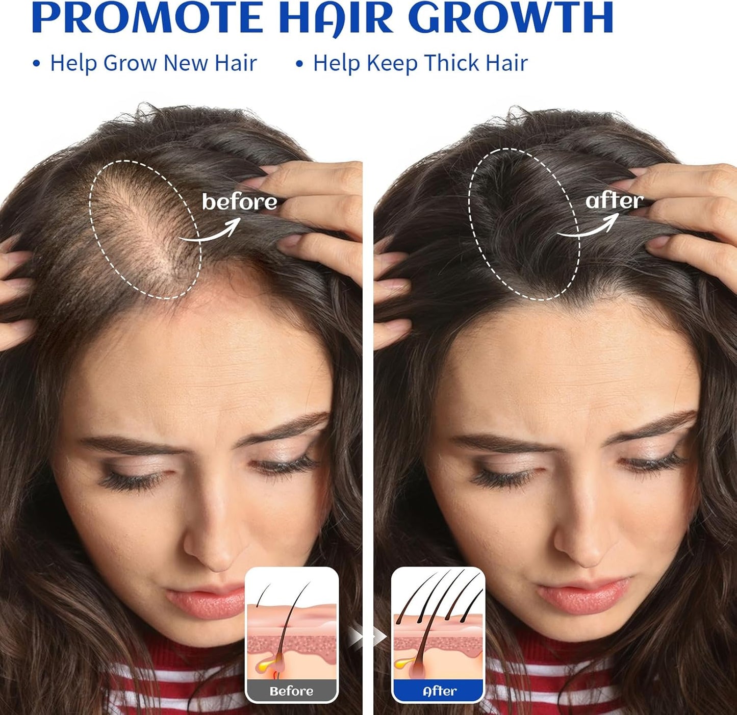 HIQILI Rosemary Oil for Hair Growth, Add to Shampoo & Conditioner, 100% Pure Undiluted - 16 Fl Oz