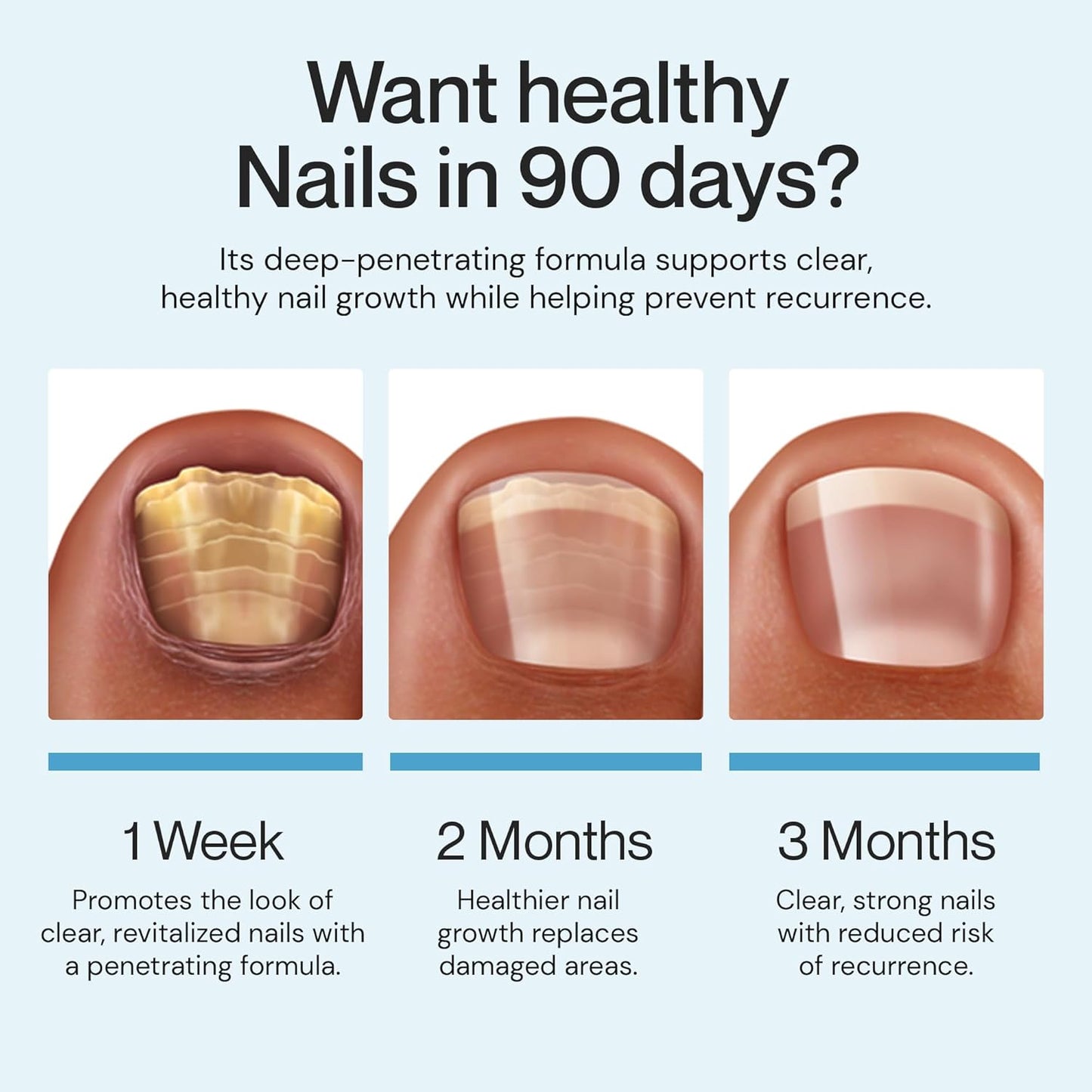 Nail Care/Conditioning Pen – Botanical Oils for Healthy, Clear-Looking Toenails and Fingernails – Fast Precision Brush Application Nail Repair Pen, Appearance of Clear Nails - Pack of 3