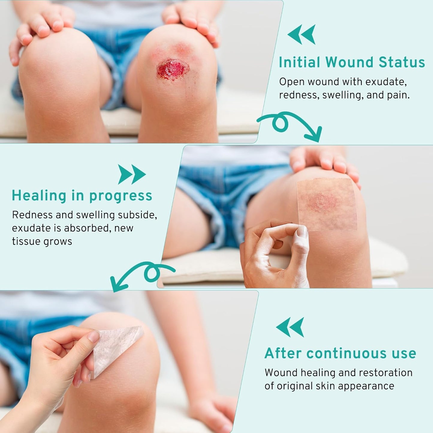 Upadated Hydrocolloid Bandages,3 Pack*5FT Hydrocolloid Roll for Wound Care,Medical-Grade Hydrocolloid Patch Bandages with Self-Adhesive, Flexible & Waterproof DIY Size & Shape (2in*15ft)