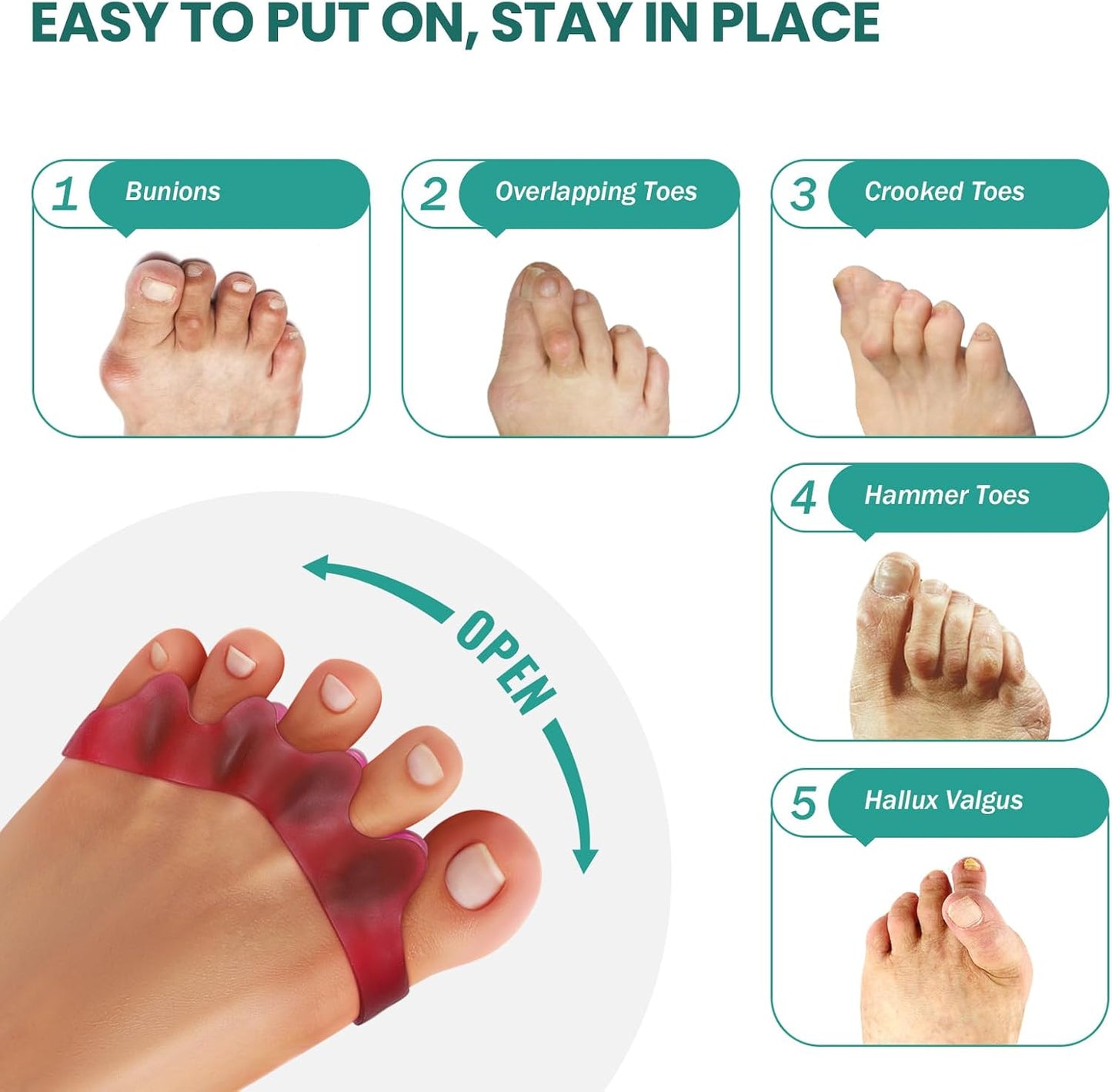 Welnove Toe Separator Bunion Corrector - 8 Pcs Gel Toe Straightener to Restore Hammertoes to Their Original Shape for Women Men, Toe Spacers for Gifts (Deep Red)