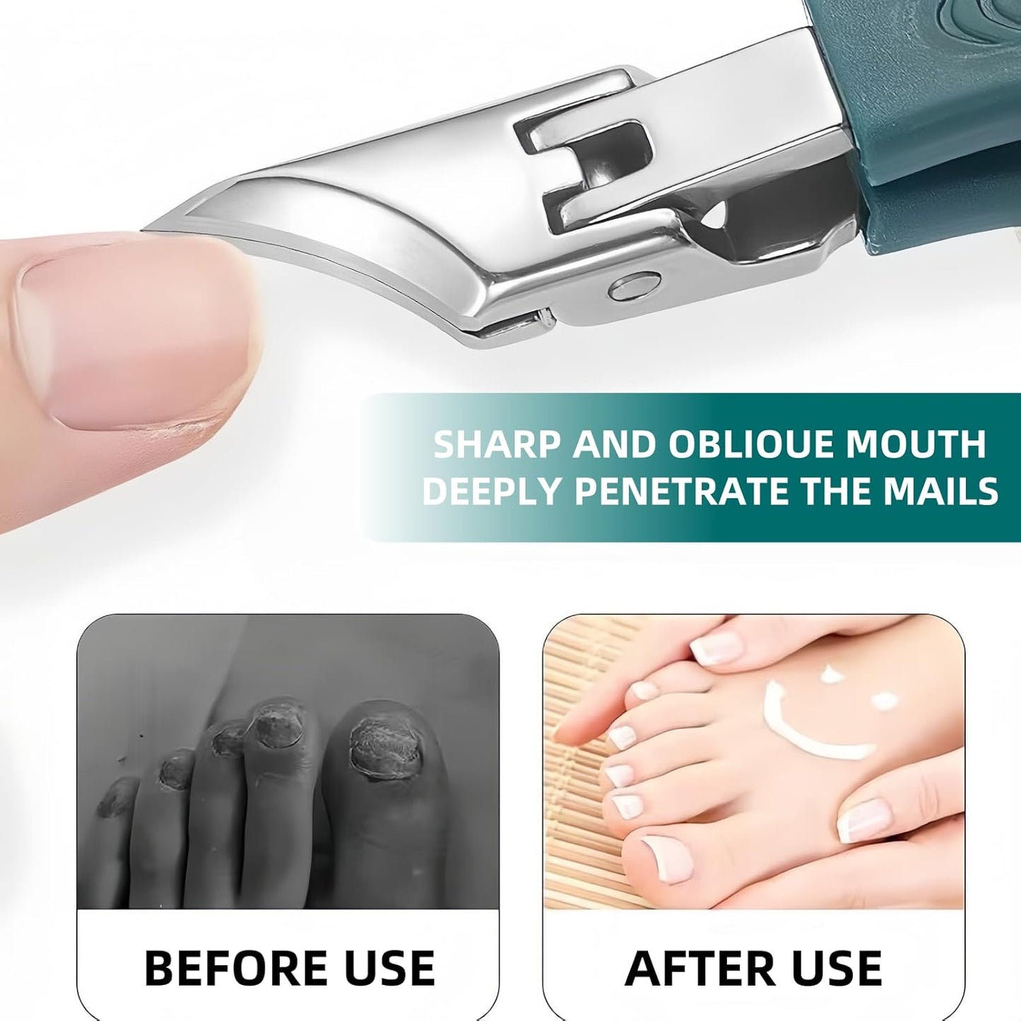 9-Piece Ingrown Toenail & Thick Nail Clipper, Eagle Beak Beveled Nail Clippers,Angled Nail Clippers,Suitable for Men,Women,and Comfort-Seeking Seniors at Home,in The Office,and During Travel (Black)