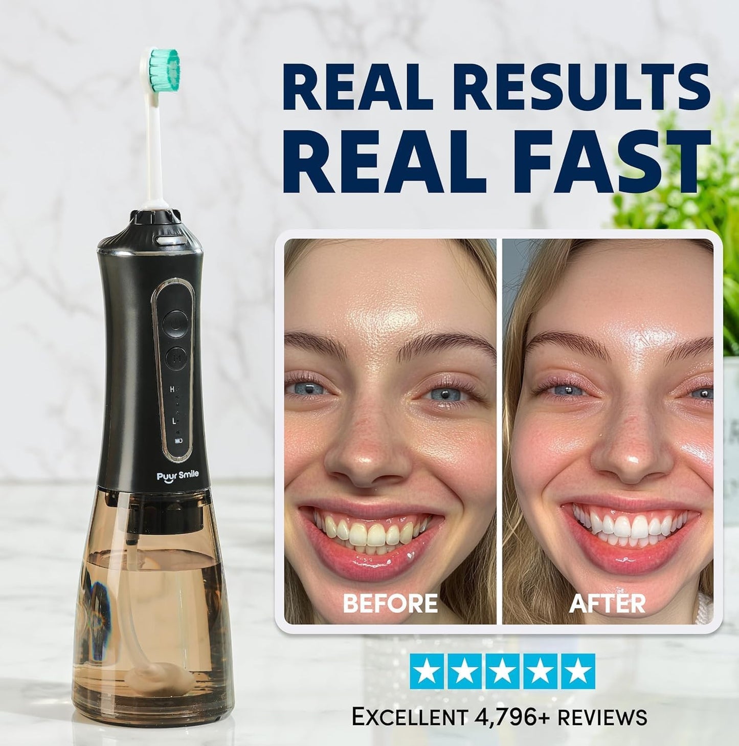 Professional Water Flosser - Advanced Dental Care for a Healthier Mouth, Gum, and Teeth - IPX7 Waterproof Oral Irrigator | 7 Replacement Tips, Travel-Friendly, Rechargeable - Oral Hygiene