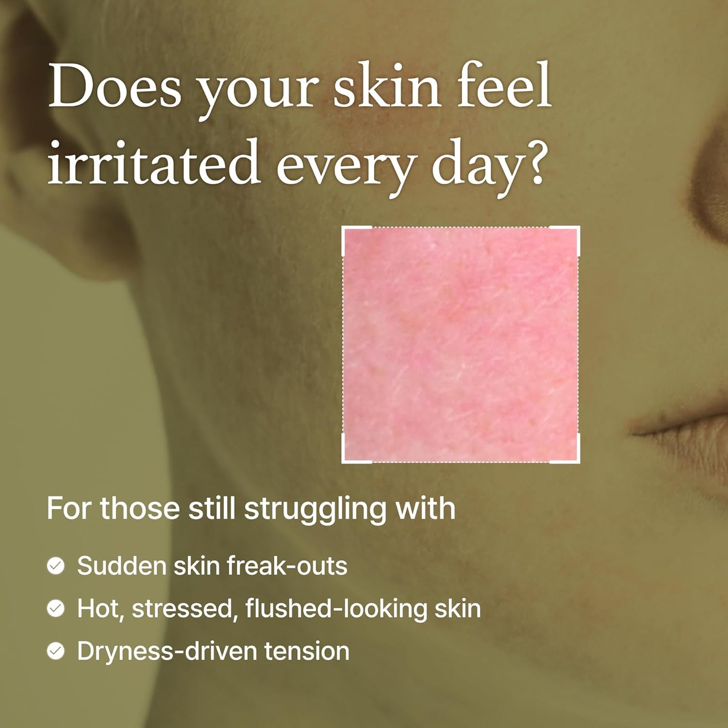 I'm From Mugwort Essence | Vegan Extract - Soothe Sensitive and Irritated Skin, Redness Relief, Refreshing, Korean Hydrating Toner | 5.4 Fl Oz, All Skin Types, PETA Approved