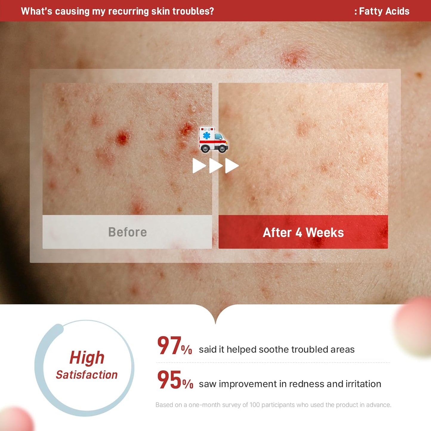 Zeroca 86 Korean Toner for Acne-Prone & Oily Skin – Fast Calming & Soothing for Breakout Relief – Calms Redness & Supports Clear Skin (6.76 fl.oz. 200ml)