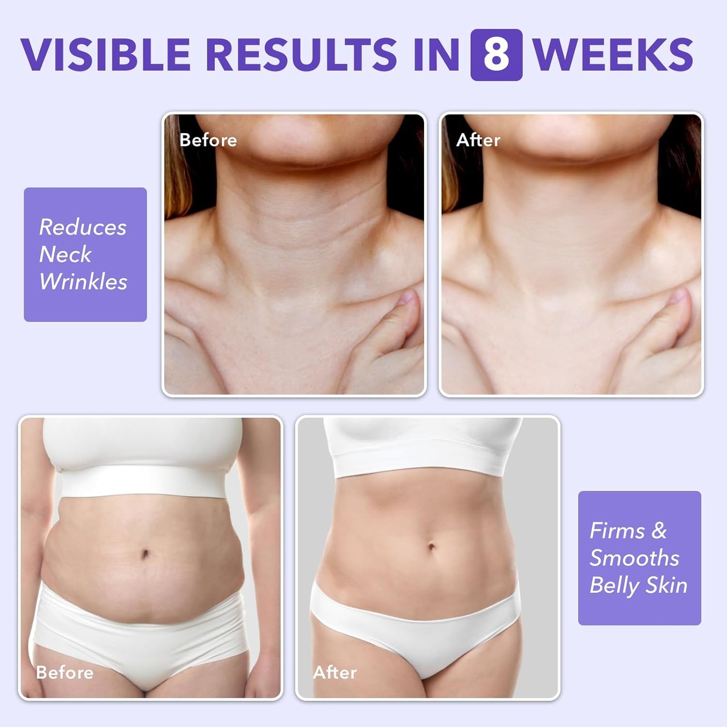 Overnight Toning Whip, Anti-Wrinkle Firming Body Lotion, Smooth & Tight Skin, Helps Target Loose Skin & Stretch Marks Removal on Belly, Thighs & Booty (3.38 OZ)