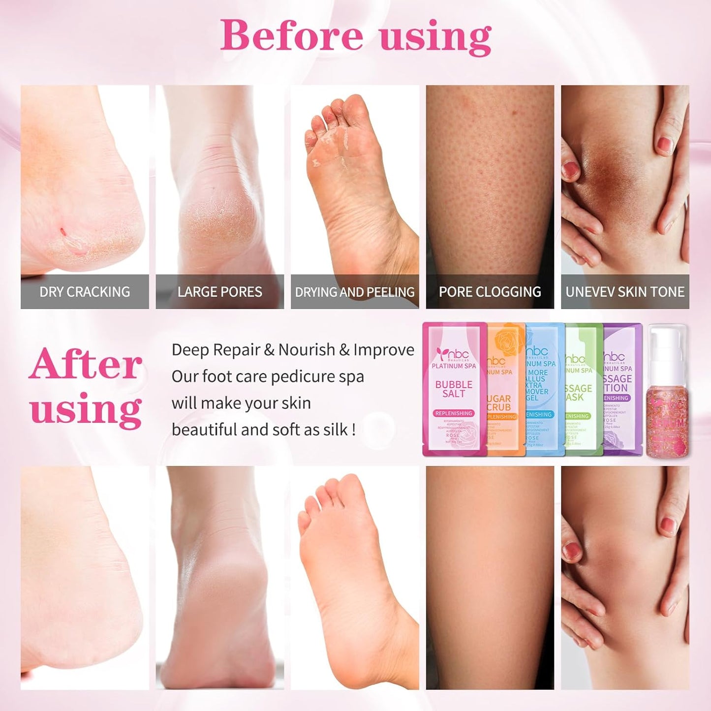 Pedicure Foot Soak Set - Upgraded 6 in 1 Foot Spa, Foot Bath Spa, Pedicure Kit, Foot Soak for Tired & Dry Cracked Feet, Athletes Feet, Bad Odor, Softens Calluses (Rose)