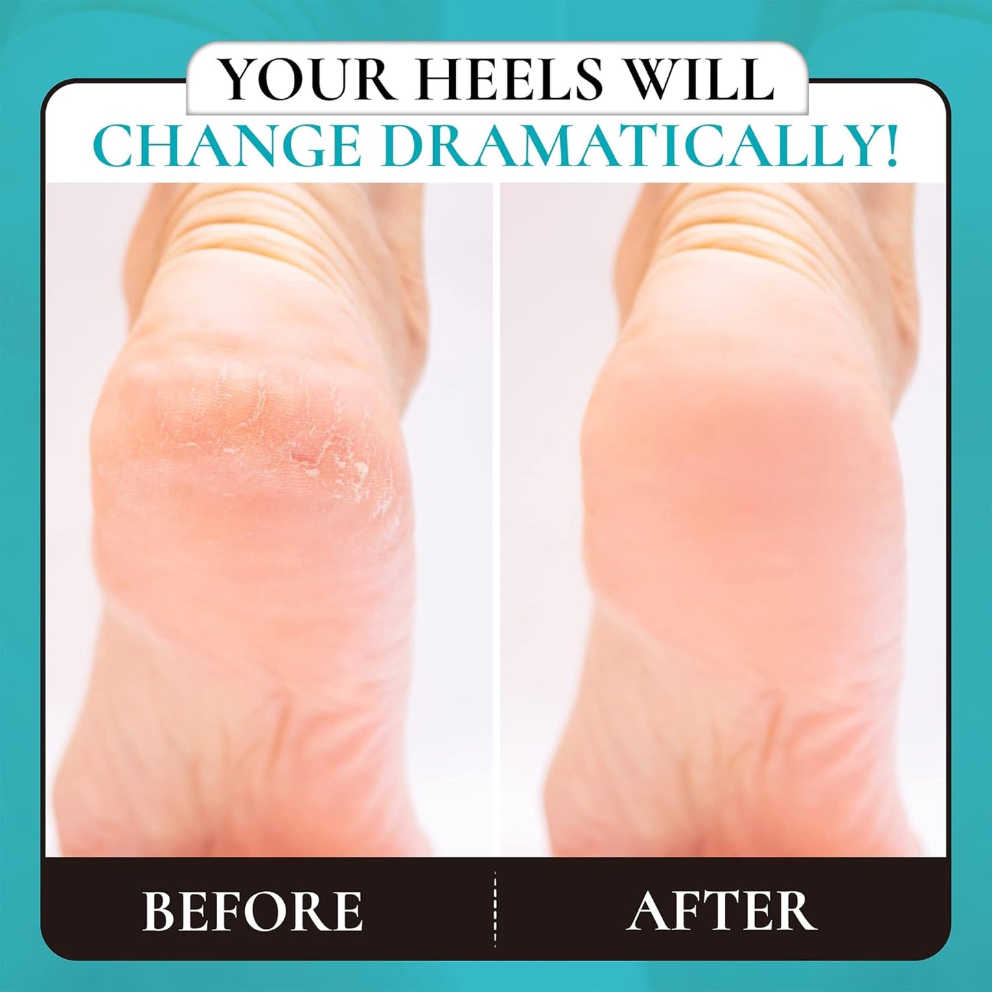 Foot rasp Pedicure Foot File - Removes Damaged and Hard Skin, Avoids Callus Buildup – Gentle, Fine File for at-Home Professional Treatment (Black, Waterproof, Comes with Original Pouch)