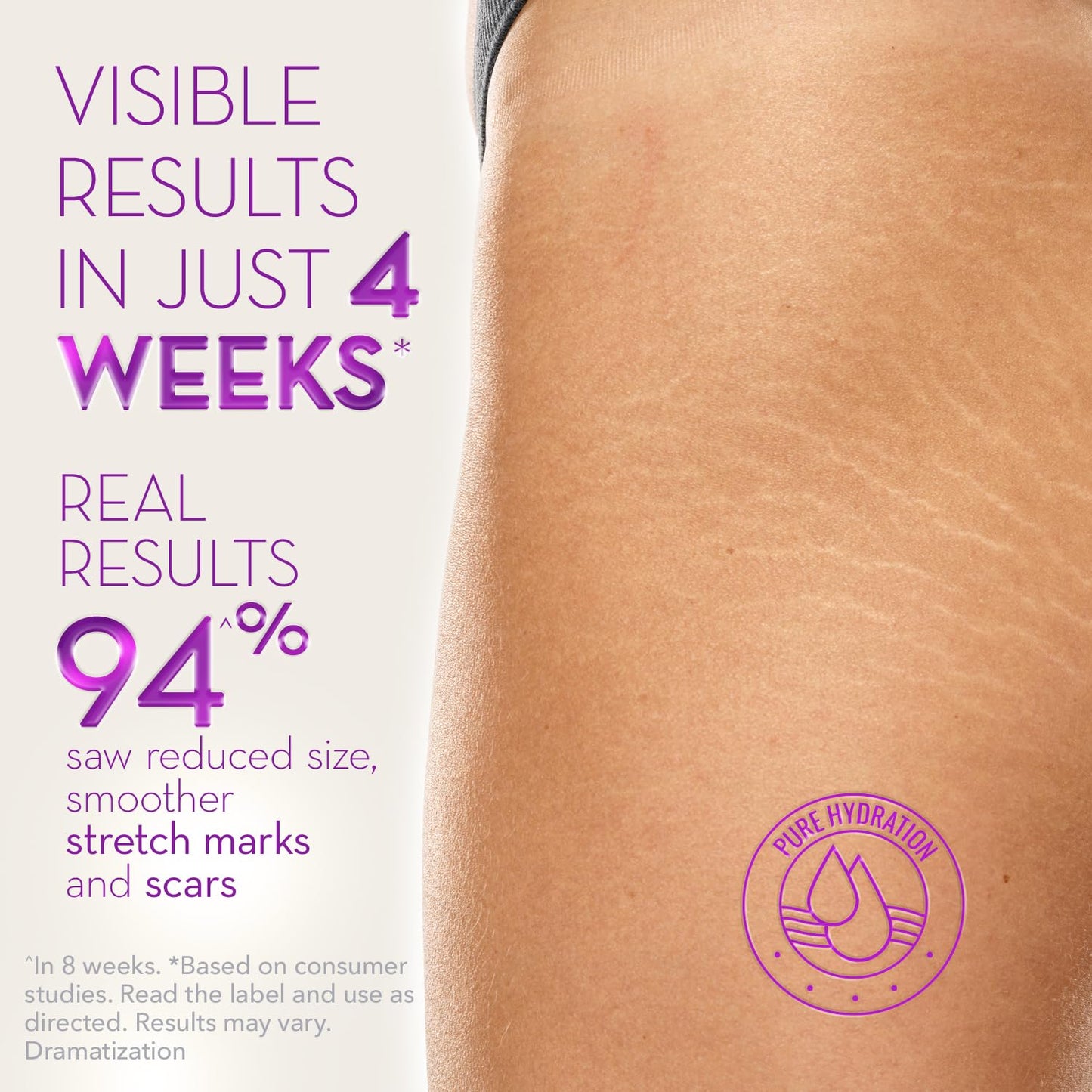 Cicatricure Cica Oil for Stretch Marks & Scars, Visible Results in 4 Weeks, Pregnancy Must-Haves Body Oil with Vitamin E, Stretch Mark Oil, Scar Treatment with Botanical Ingredients, 6.7 fl oz