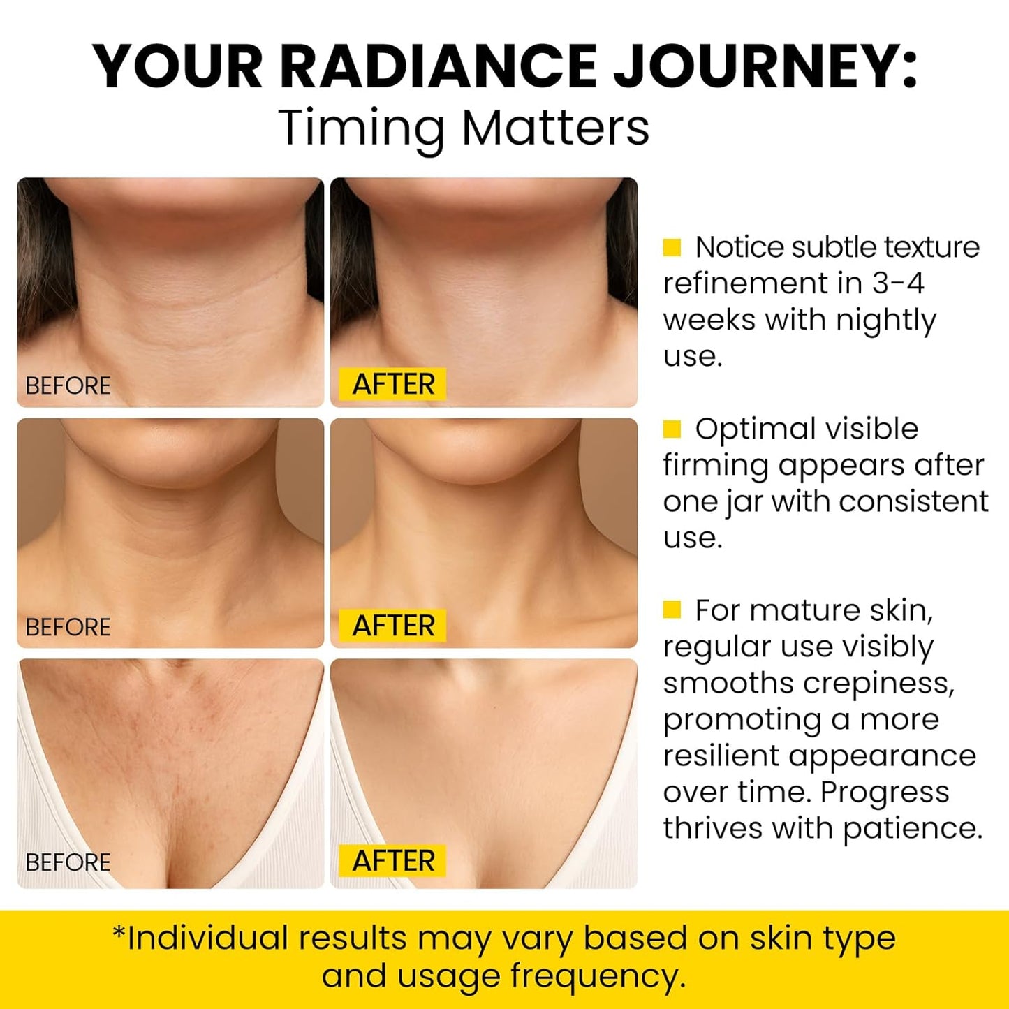 8-in-1 Radiant Neck Firming Cream, Tighten and Lift Neck Wrinkle Cream, Collagen Retinol Face and Chest Firming Tightening for Women and Men with Sagging Crepey Skin Over 50 & 60