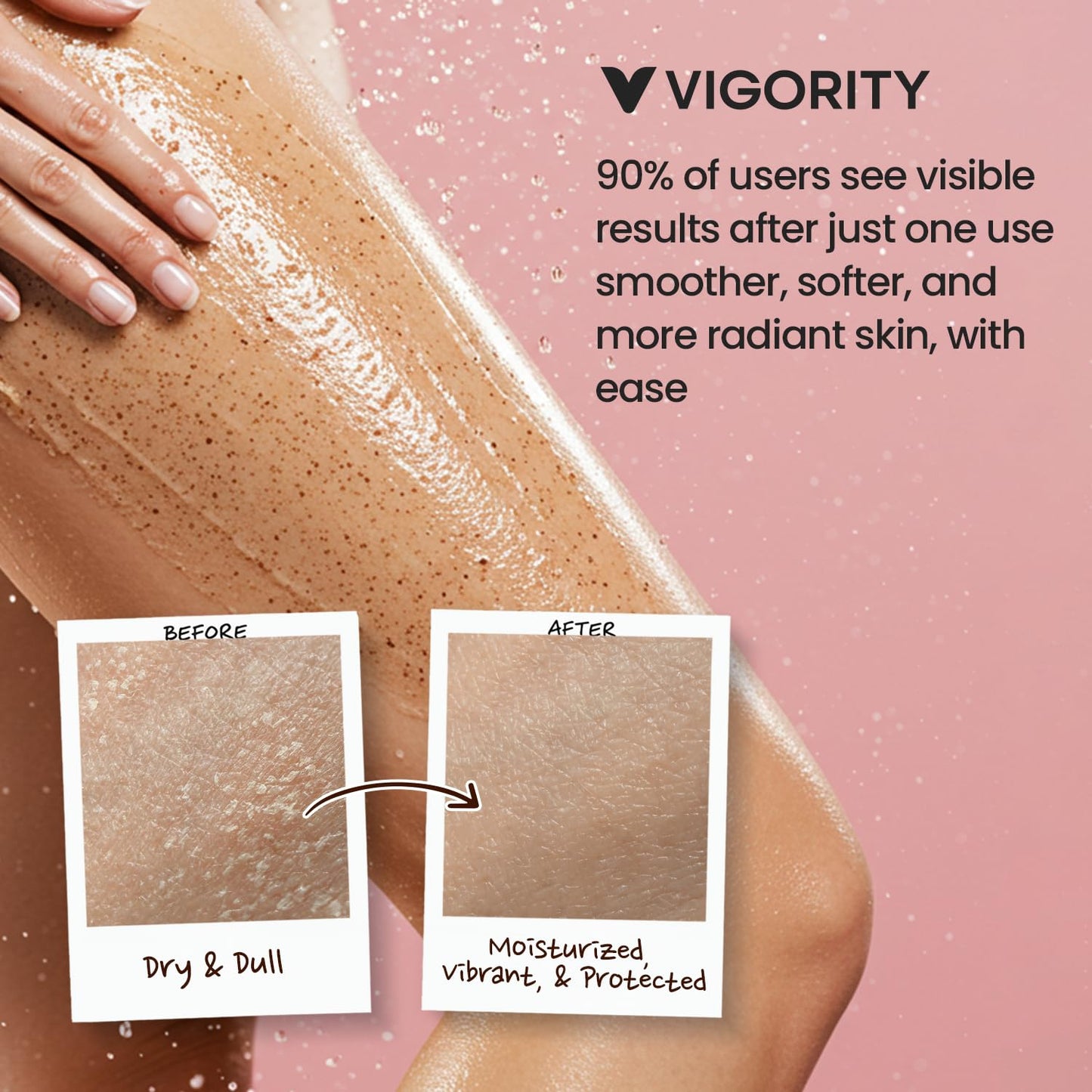 Vigority KP Bump Eraser Body Scrub: Keratosis Pilaris Treatment for Strawberry Legs - Exfoliates & Deeply Hydrates for Smoother Healthy-Looking Skin