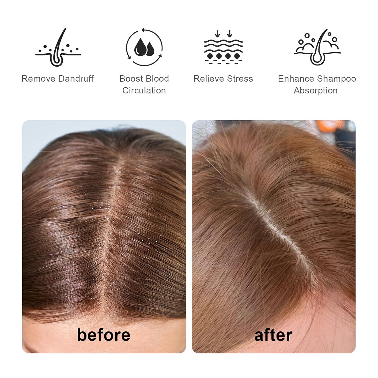 RHOS Scalp Massager, Shampoo Brush with Handle, Curved Vented Hair Scrubber, Scalp Brush for Wet & Dry Hair (Blue)