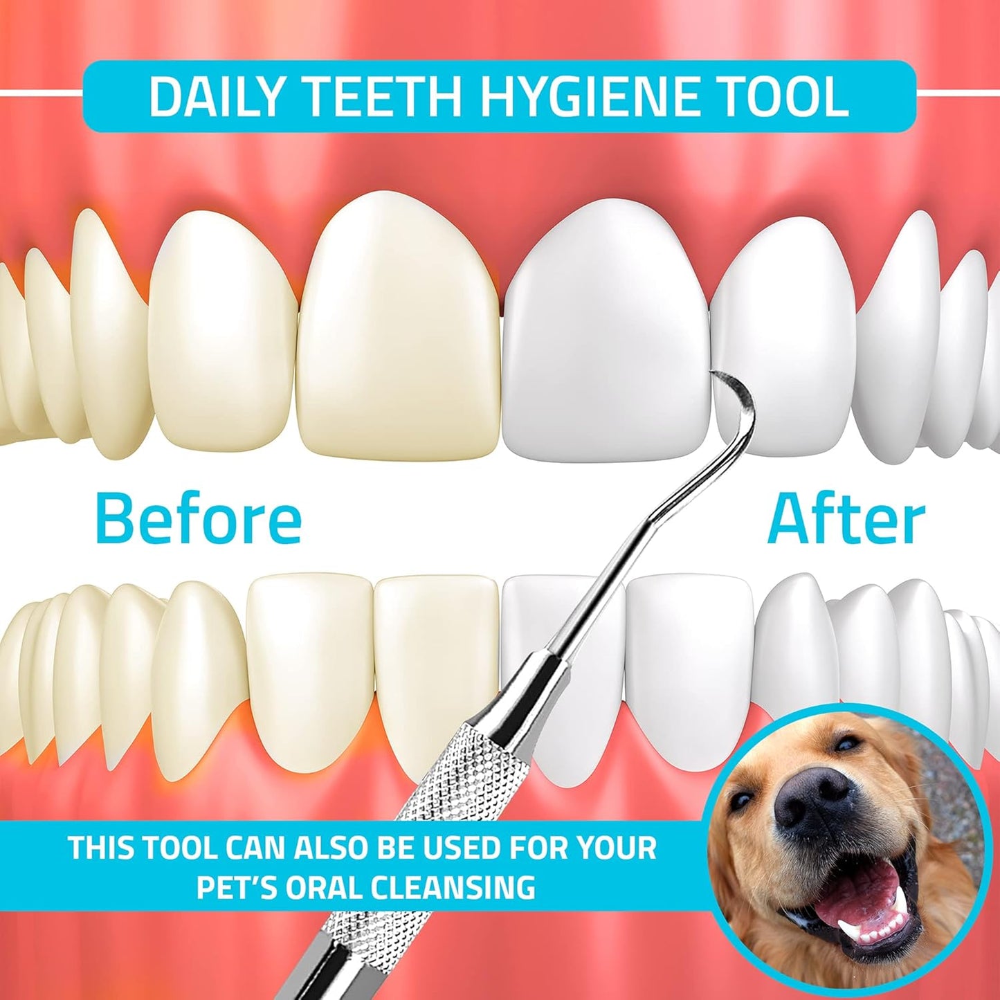 Utopia Care Professional Dental Tartar Scraper Tool, Dental Pick, 6.5 Inch Double Ended Tartar Remover for Teeth, Plaque Remover, Tooth Scraper, Silver, Pack of 6