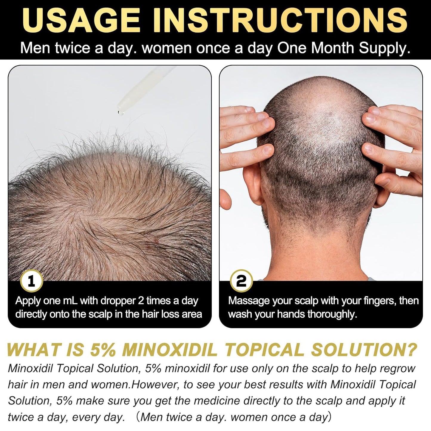 5% Minoxidil for Men and Women Hair Growth Serum, Biotin Hair Growth, Hair Regrowth Treatment for Scalp Hair Loss Hair Thinning for Thicker Longer Fuller Healthier Hair (Pack of 1)