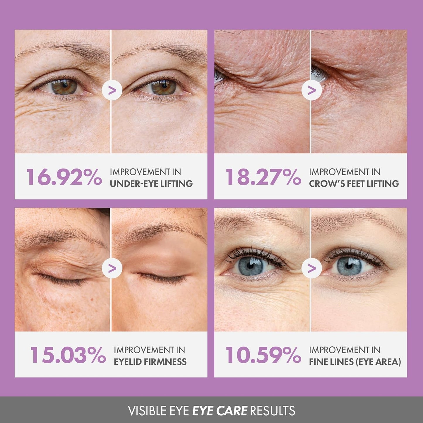 KAHI Eye Balm CV - Age-Defying, Hydrating, 3D Lifting Under Eye Moisturizer Stick with Beluga Caviar Oil - Corrector for Dark Circles – Luxury Korean Skincare (9g, 0.31 oz)