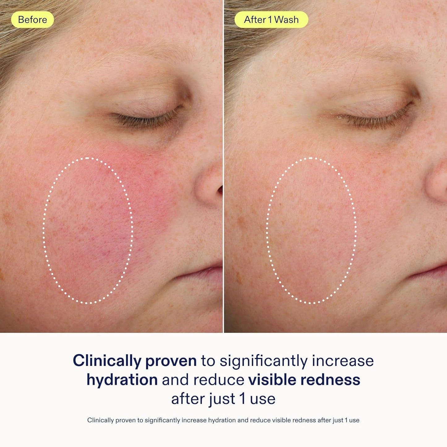 Skinfix Foaming Oil Cleanser - 6 oz - Rich Gel-to-Foam Face Cleanser to Hydrate & Soothe Dry, Sensitive Skin - Fragrance Free, Vegan, Cruelty Free