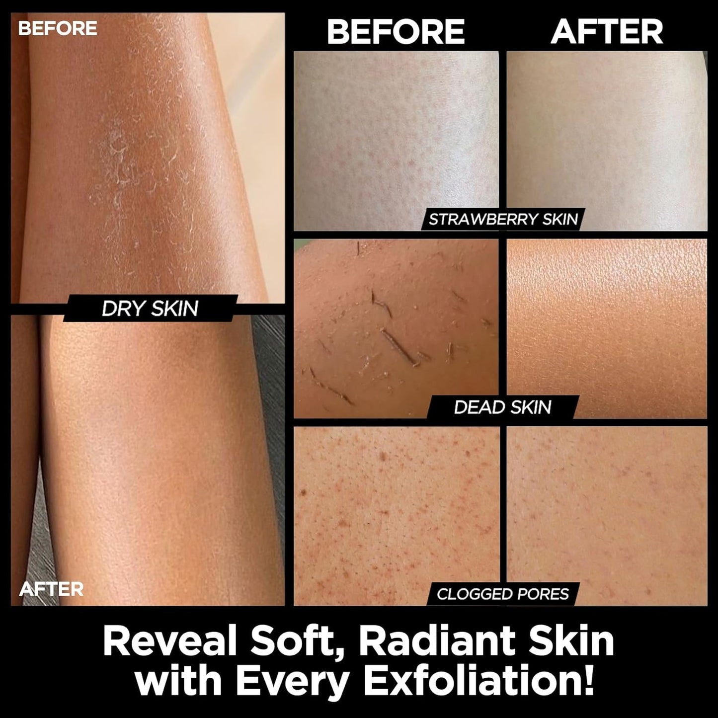 Exfoliating Glove Kessa Mitt Body Scrubber - Dead Skin Remover Shower Glove for Dead Skin Scrubbing and Deep Pore Cleansing - by MoroccanSource (1 Pack Black)