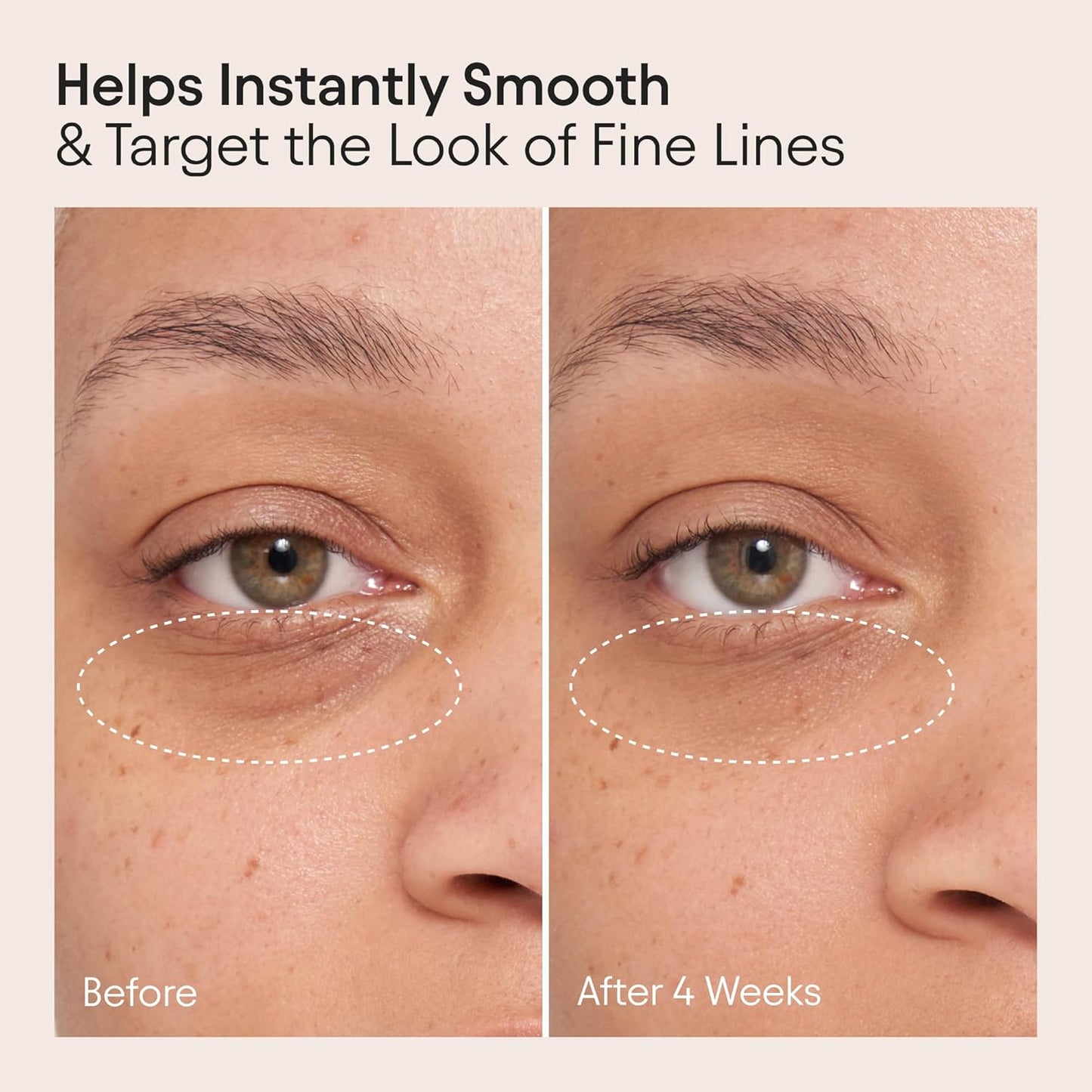 Alpyn Line-Filling Eye Balm with Bakuchiol & Caffeine, Reduce the Look of Fine Lines & Wrinkles, Minimize the Appearance of Puffiness & Target Dark Circles, 0.5 oz / 14 ml