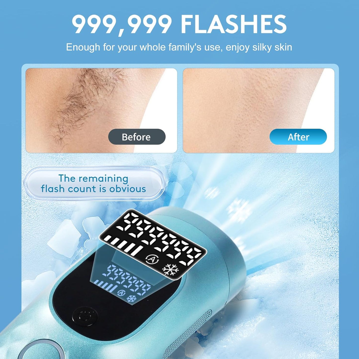 Laser Hair Removal for Women and Men - Permanent Painless Ice Cooling IPL Device Remover Machine with Shaver, Goggles, 999,999 Flashes for Body and Face, Corded