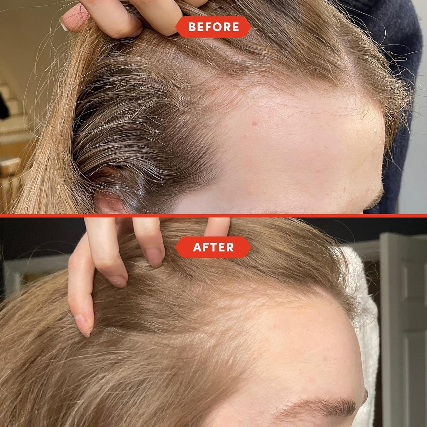 Fable and Mane Hair Oil - HoliRoots Strengthening Serum for Damaged, Frizzy Hair with Amla, Castor Oil for Hair Health - 3.4FL oz