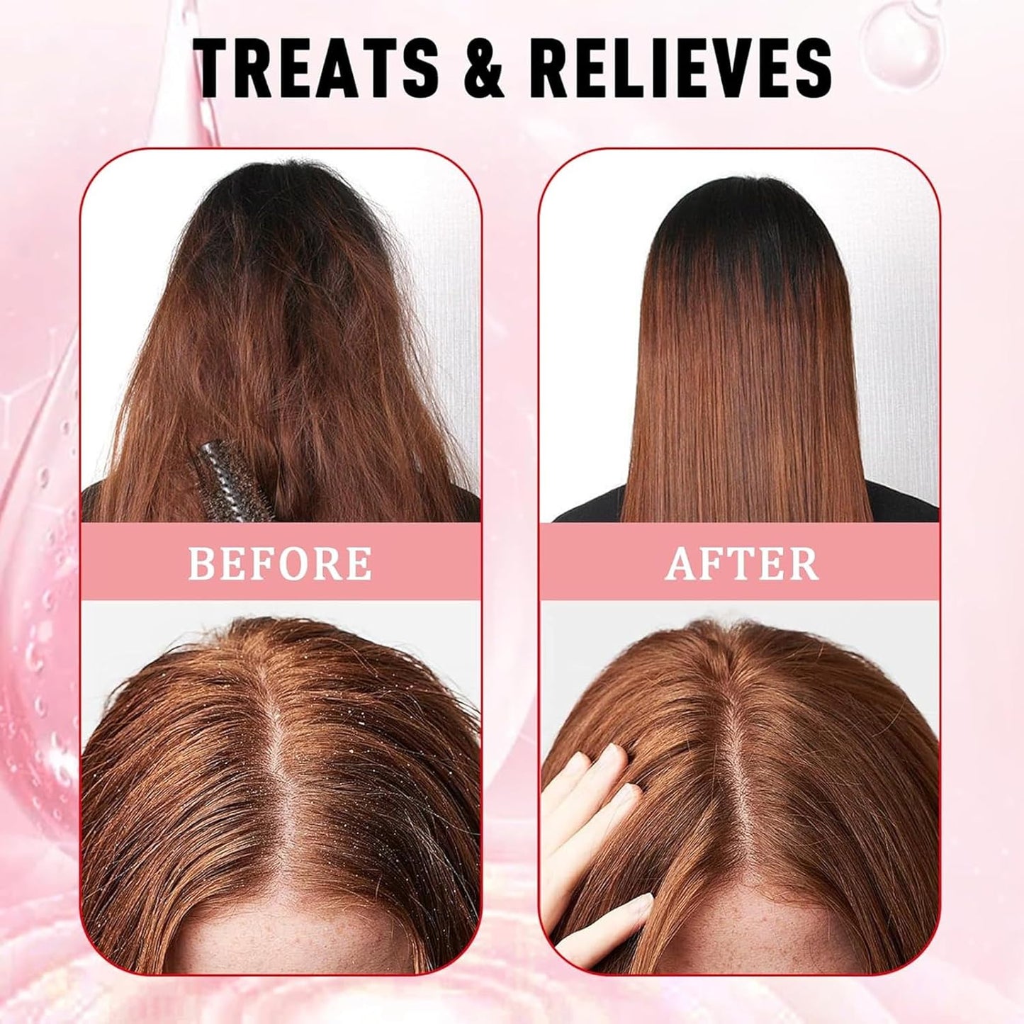 Avocado Oil Scalp Scrub, Rich in Grapefruit Extract, Grapeseed Extract & Pumice, Natural Exfoliating Scrub & Dry Scalp, Gluten Free, Vegan, 5.29OZ