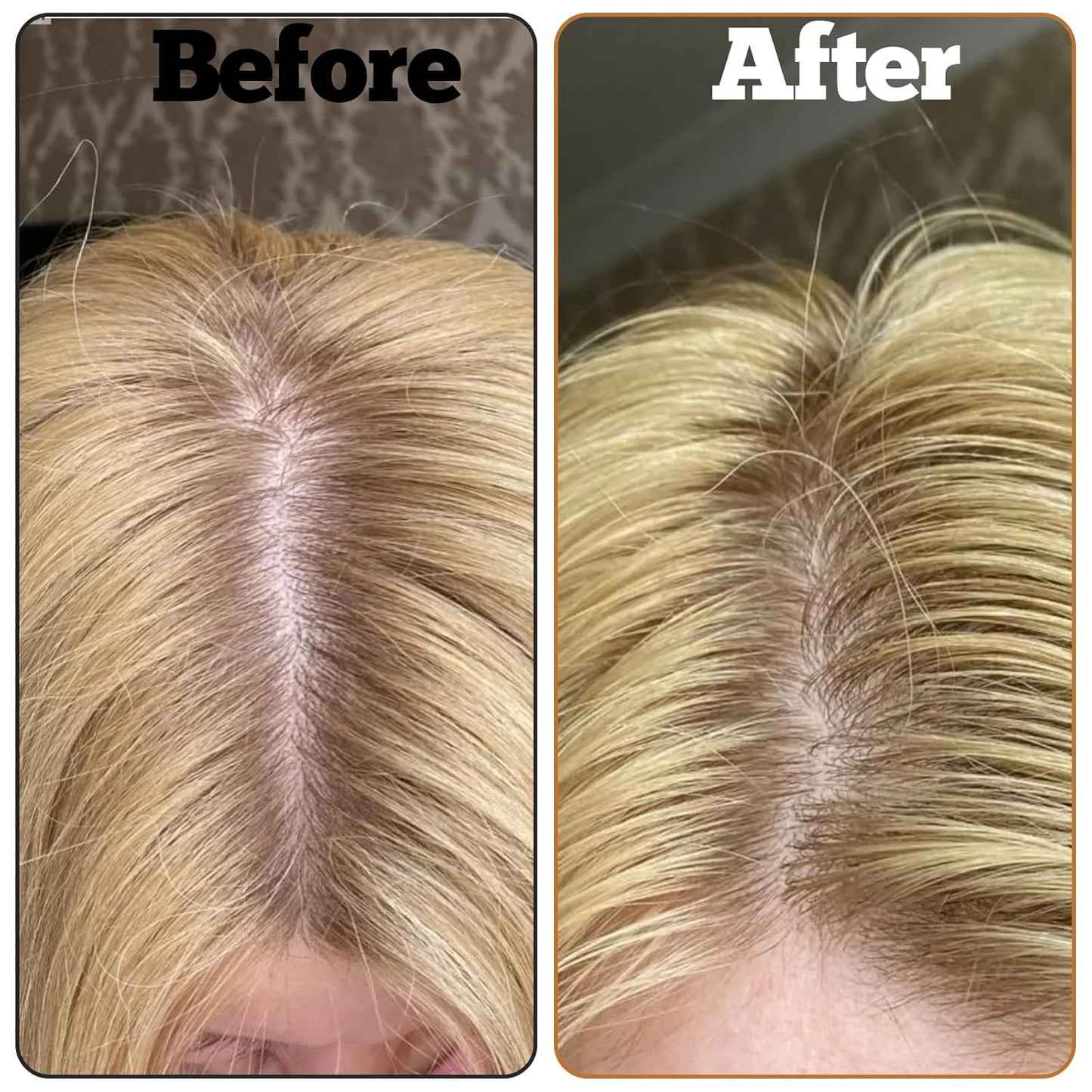 JIEYAO 2 Pcs Dual Ended Hairline Powder Brushes, Precision Makeup Brush Root Concealer Brush Set with Sponge Tip and Soft Bristles for Covering Hair Root Touch Up Contouring Blending