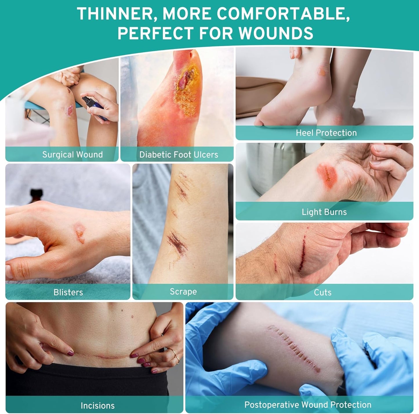 Upadated Hydrocolloid Bandages,3 Pack*5FT Hydrocolloid Roll for Wound Care,Medical-Grade Hydrocolloid Patch Bandages with Self-Adhesive, Flexible & Waterproof DIY Size & Shape (2in*15ft)