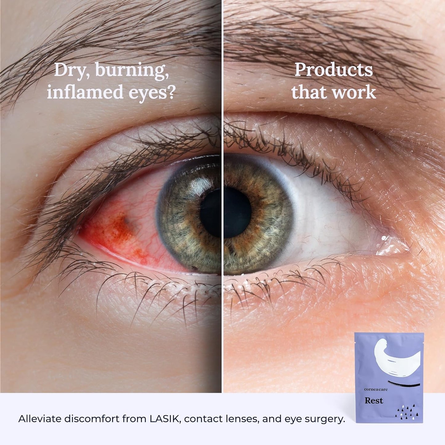 Rest: Self Heating Warm Compress for Dry Eyes | Heated Eye Mask for Fast Relief | No Microwave or Washcloth Needed | Travel Ready | 30 Count